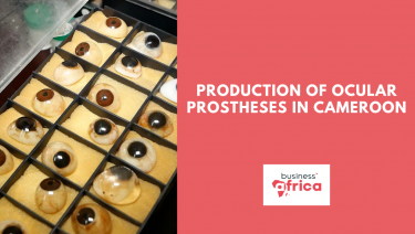 The production of ocular prostheses in Cameroon